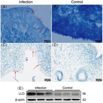 Listeria monocytogenes: possible mechanism of infection of goat uterus and its effects on uterine autophagy and cell apoptosis